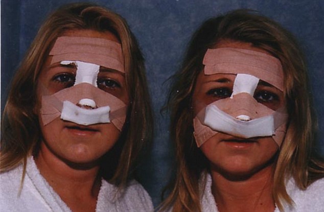 Oto Jo i Kerry Burton - bliżniaczki uzależnione od operacji