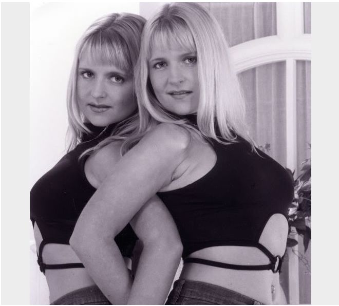 Oto Jo i Kerry Burton - bliżniaczki uzależnione od operacji