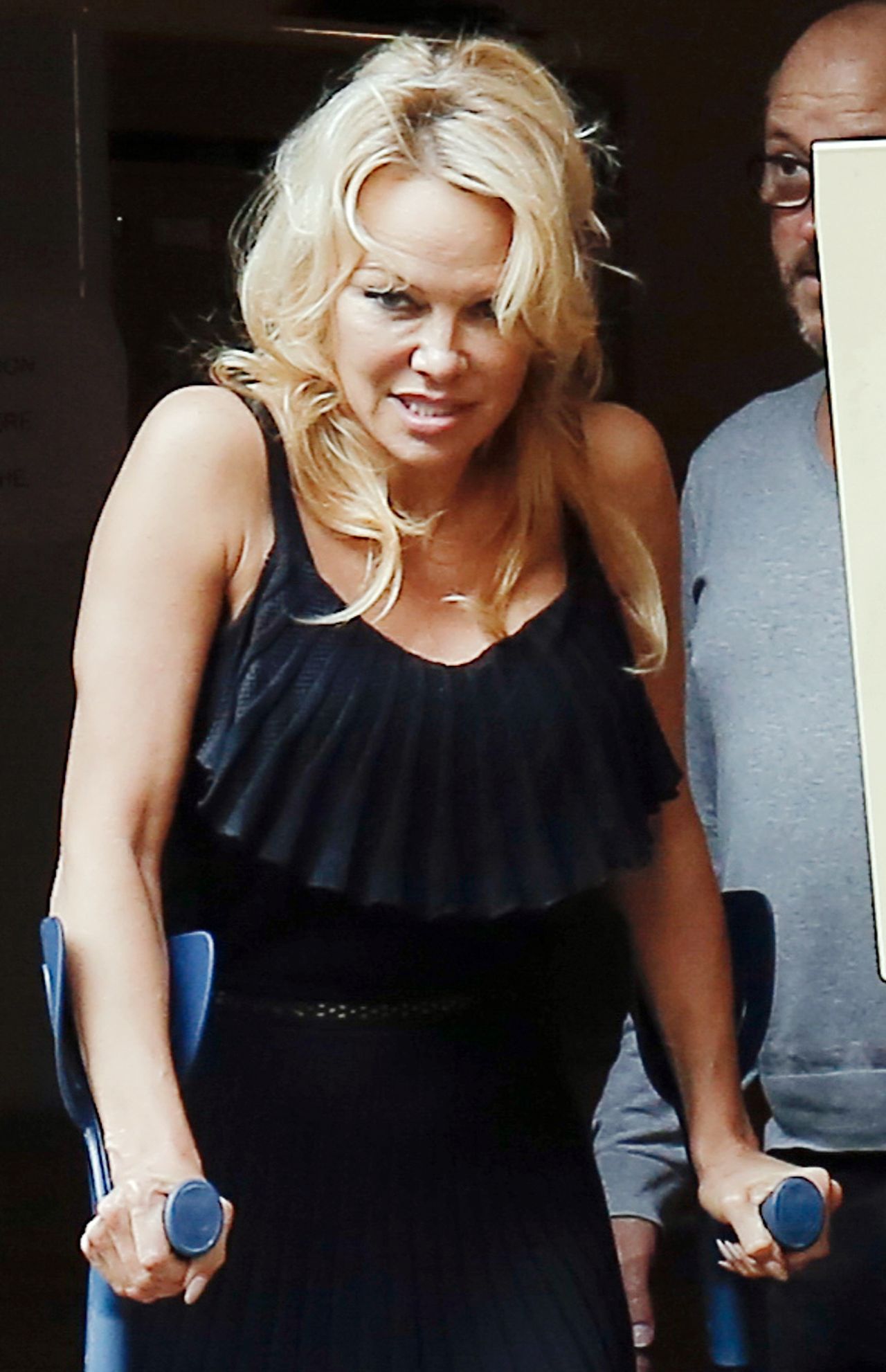 Obolała Pamela Anderson wychodzi od lekarza o kulach (ZDJĘCIA)