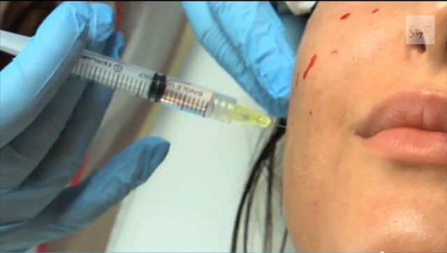 Patrycja Pająk znowu coś sobie poprawiała