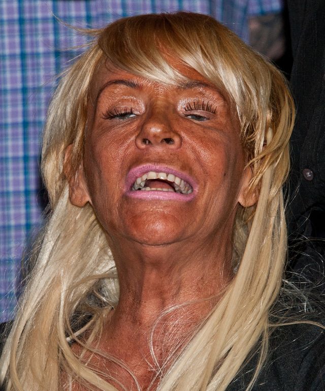 Patricia Krentcil - tej pani nie tylko oczko się zepsuło Patricia Krentcil - tej pani nie tylko oczko się zepsuło