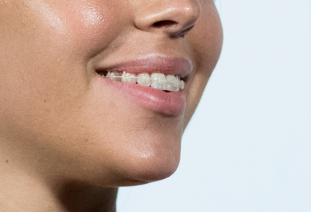 Dziewczyna Cristiano Ronaldo chciała ukryć TO CO MA NA zębach! 