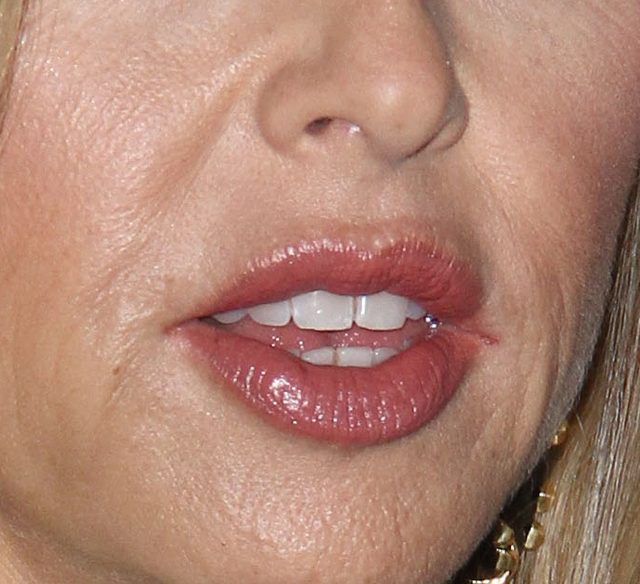 Nadal twierdzi, że nie jest za chuda? (FOTO)