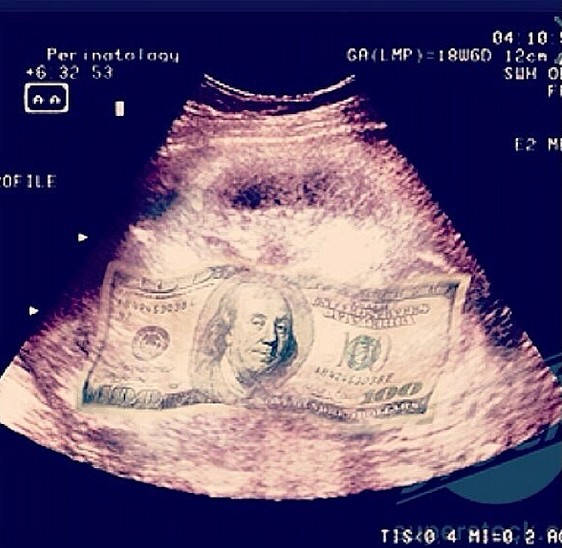 Rihanna pochwaliła się zdjęciem z USG! (FOTO)