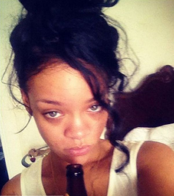 Te gwiazdy borykają się z trądzikiem (FOTO)