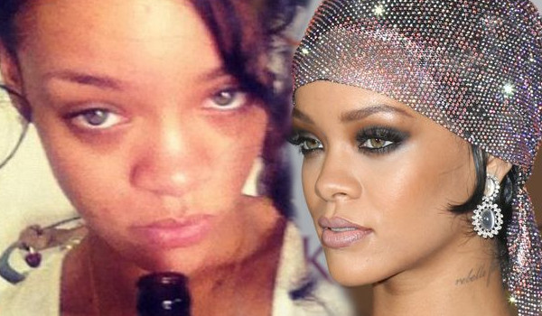 Te gwiazdy borykają się z trądzikiem (FOTO)