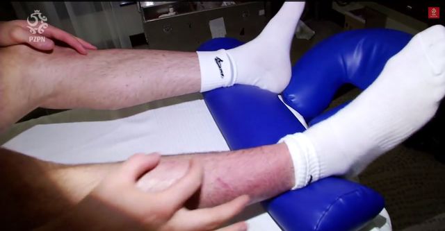 Robert Lewandowski pokazał kontuzjowaną nogę (VIDEO) Robert Lewandowski pokazał kontuzjowaną nogę (VIDEO)