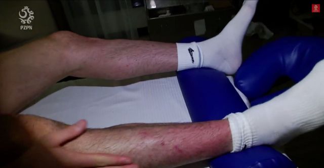 Robert Lewandowski pokazał kontuzjowaną nogę (VIDEO) Robert Lewandowski pokazał kontuzjowaną nogę (VIDEO)