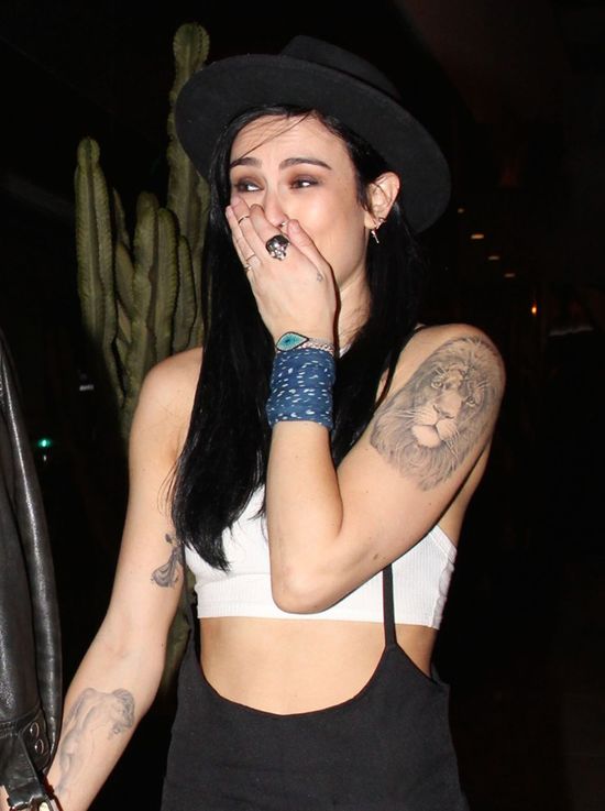 Kontuzja nie powstrzymała jej przed imprezowaniem (FOTO) Kontuzja nie powstrzymała jej przed imprezowaniem (FOTO)