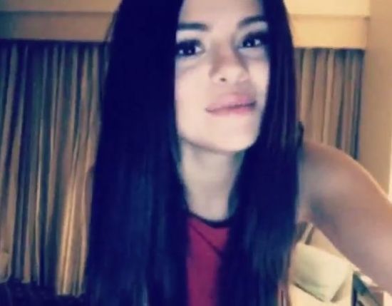 Czy pszczoła użądliła Selenę Gomez w usta? (FOTO)