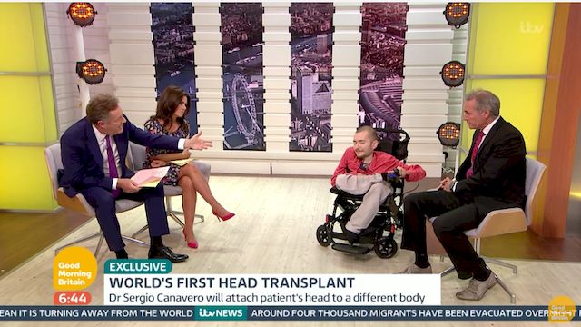 Pierwsza w historii transplantacja CAŁEJ GŁOWY jest możliwa?! (VIDEO) Pierwsza w historii transplantacja CAŁEJ GŁOWY jest możliwa?! (VIDEO)