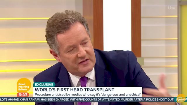 Pierwsza w historii transplantacja CAŁEJ GŁOWY jest możliwa?! (VIDEO) Pierwsza w historii transplantacja CAŁEJ GŁOWY jest możliwa?! (VIDEO)