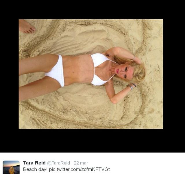 Ofiara nieudanej liposumcji zagra w horrorze (FOTO) Ofiara nieudanej liposumcji zagra w horrorze (FOTO)