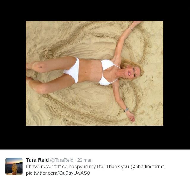 Ofiara nieudanej liposumcji zagra w horrorze (FOTO) Ofiara nieudanej liposumcji zagra w horrorze (FOTO)