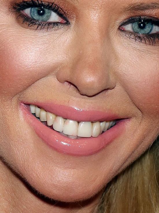 Hollywoodzka gwiazda z TAKIM UŚMIECHEM? (FOTO)