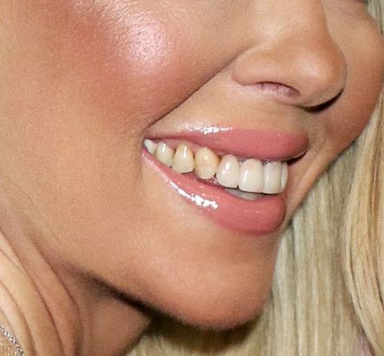 Hollywoodzka gwiazda z TAKIM UŚMIECHEM? (FOTO)