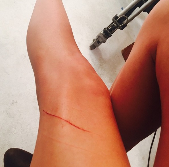 Atak na ubezpieczone na 40 milionów nogi Taylor Swift! Atak na ubezpieczone na 40 milionów nogi Taylor Swift!