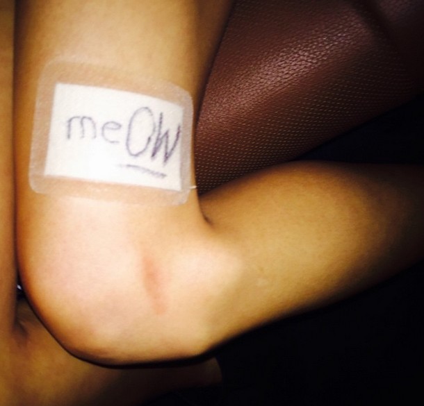 Atak na ubezpieczone na 40 milionów nogi Taylor Swift! Atak na ubezpieczone na 40 milionów nogi Taylor Swift!