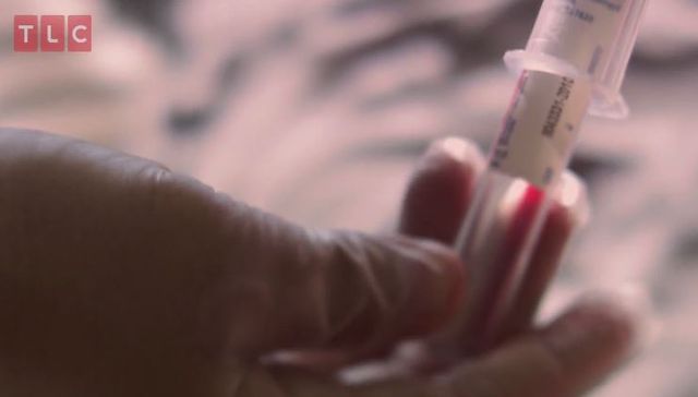 Był coraz słabszy. Okazało się, że to pasożyty wywołały STRASZNĄ chorobę (VIDEO)