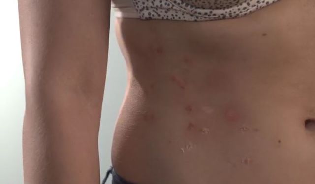 Od lat żyją z TYMI dolegliwościami. Ich życie całkowicie się zmieniło (VIDEO)