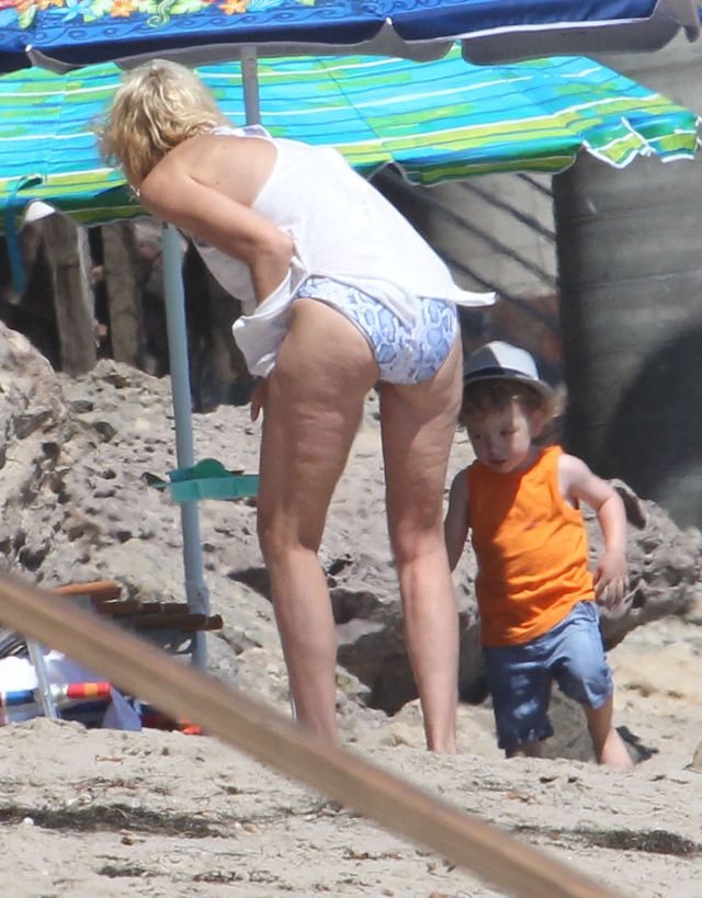 To, że jest chuda, nie znaczy, że nie może mieć cellulitu 