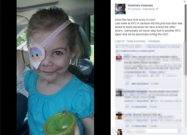 Historia z KFC i okaleczoną Victorią to KŁAMSTWO?!