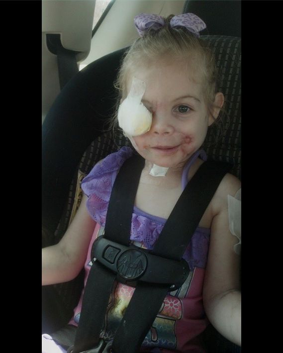 3-letnia Victoria wyproszona z KFC, bo jej twarz straszy