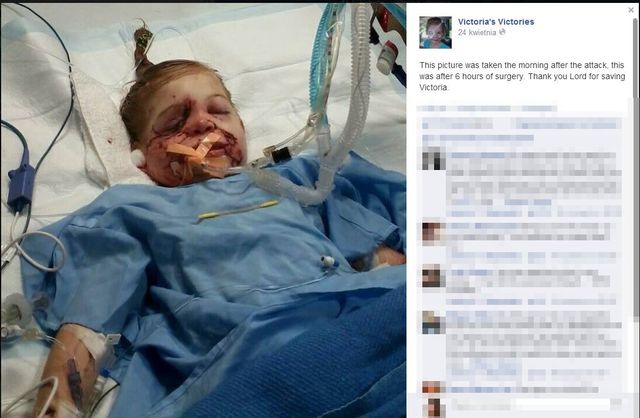 3-letnia Victoria wyproszona z KFC, bo jej twarz straszy