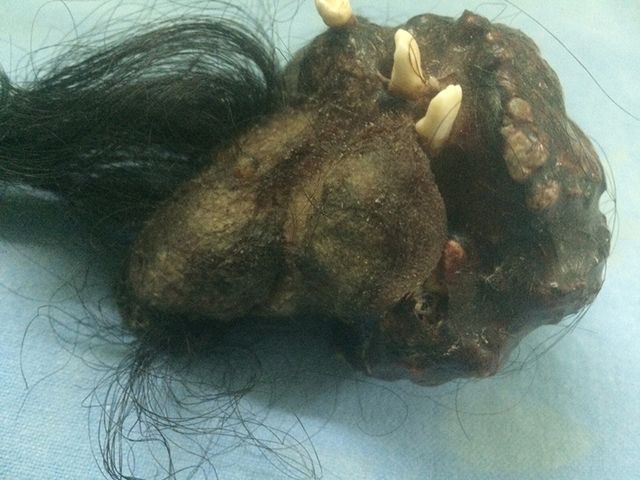 To co lekarze znaleźli w jego żołądku jest przerażające!