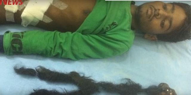 To co lekarze znaleźli w jego żołądku jest przerażające!