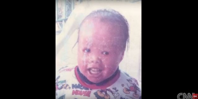 Rodzice porzucili ją, bo przestraszyli się jej wyglądu VIDEO Rodzice porzucili ją, bo przestraszyli się jej wyglądu VIDEO