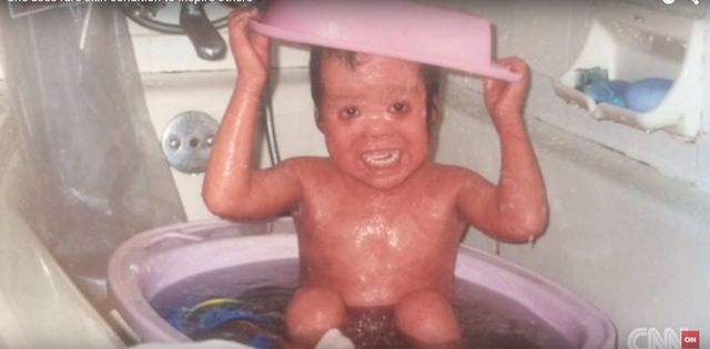 Rodzice porzucili ją, bo przestraszyli się jej wyglądu VIDEO Rodzice porzucili ją, bo przestraszyli się jej wyglądu VIDEO