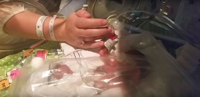 Wow! Bliźniaki urodziły się w odstępach 4 miesięcy (VIDEO) Wow! Bliźniaki urodziły się w odstępach 4 miesięcy (VIDEO)