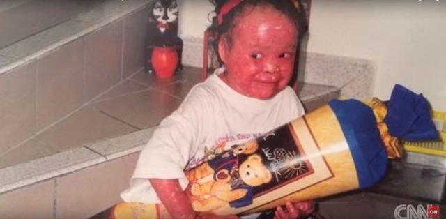 Rodzice porzucili ją, bo przestraszyli się jej wyglądu VIDEO Rodzice porzucili ją, bo przestraszyli się jej wyglądu VIDEO