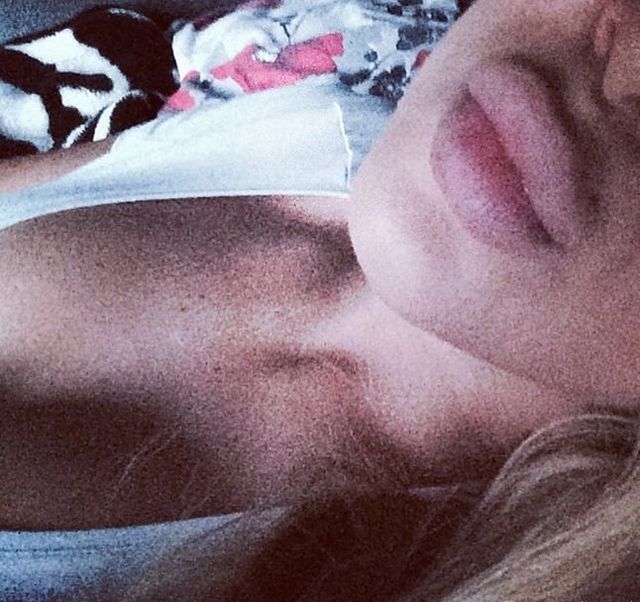 Komu tak spuchły usta? (FOTO)