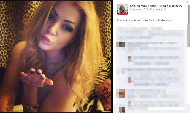 Komu tak spuchły usta? (FOTO)