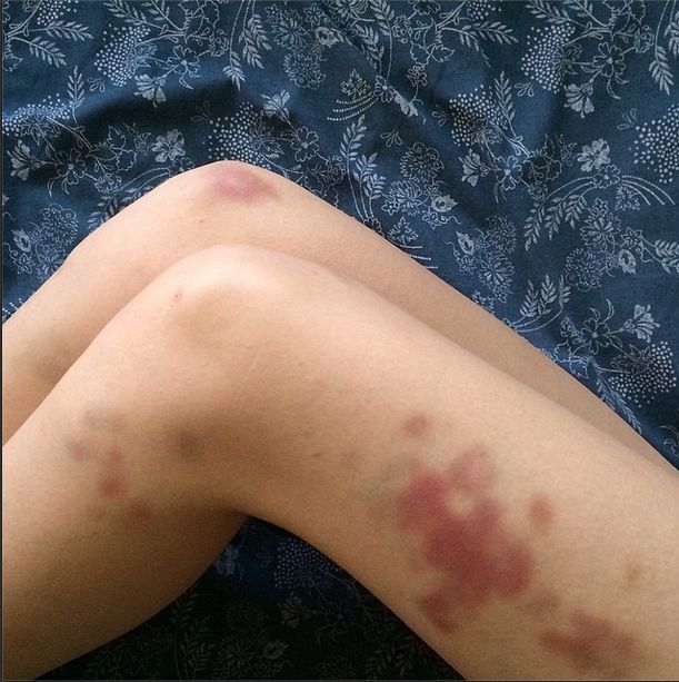 Nogi polskiej modelki wywołują niepokój (FOTO)