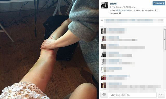 Nogi polskiej modelki wywołują niepokój (FOTO)