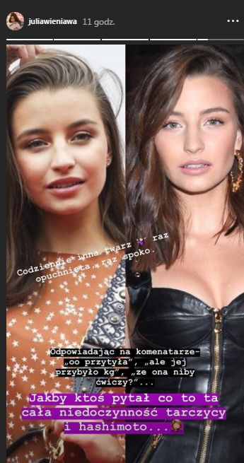 Julia Wieniawa choruje na niedoczynność tarczycy