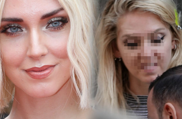 Chiara Ferragni BEZ PHOTOSHOPA i filtrów (ZDJĘCIA)