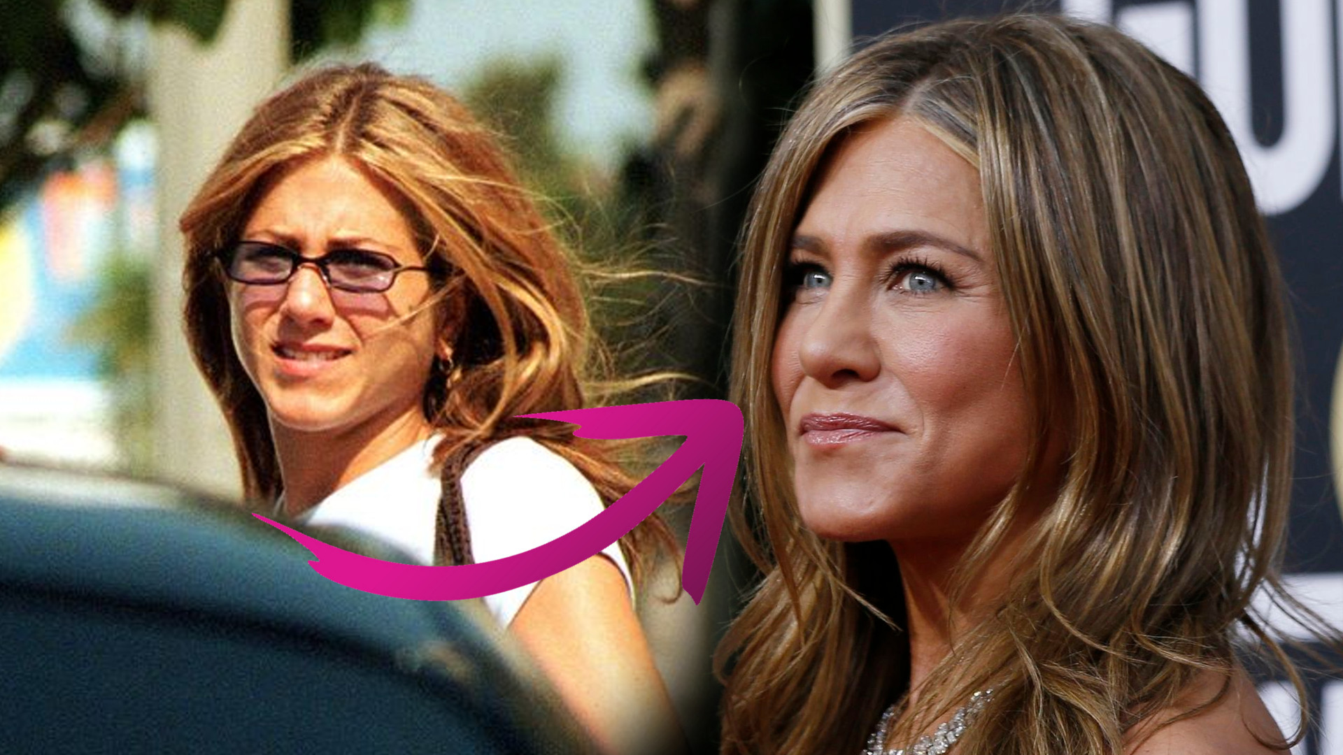 Jennifer Aniston ZOPEROWAŁA NOS! Jak wyglądała przed zabiegiem? Jennifer Aniston ZOPEROWAŁA NOS! Jak wyglądała przed zabiegiem?