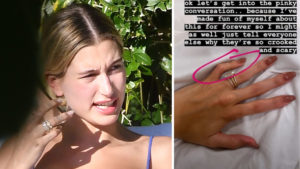 Hailey Bieber ma wrodzoną wadę. Nie mogła dłużej tego ukrywać Hailey Bieber ma wrodzoną wadę. Nie mogła dłużej tego ukrywać