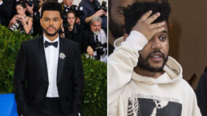 Co się stało z TWARZĄ The Weeknd? Wokalista wygląda PRZERAŻAJĄCO Co się stało z TWARZĄ The Weeknd? Wokalista wygląda PRZERAŻAJĄCO