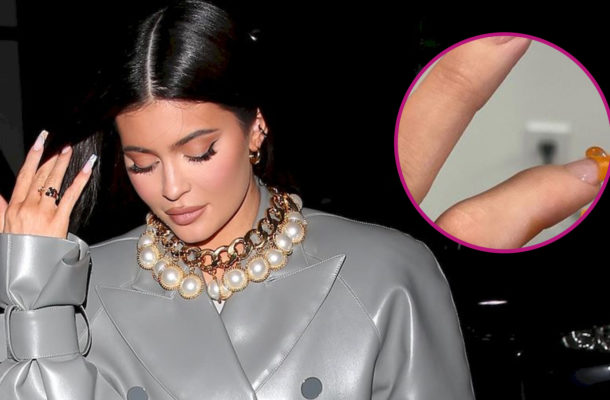 Fani są ZNIESMACZENI nowym manicure Kylie Jenner: Wygląda jak GRZYBICA