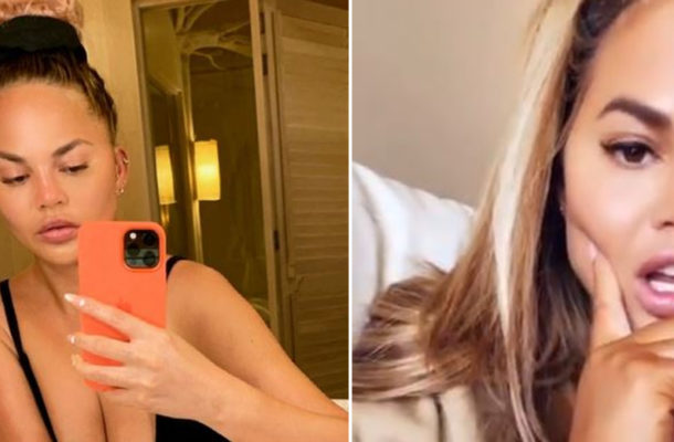 Chrissy Teigen przyznała się, że usunęła z twarzy „poduszki Bichata”