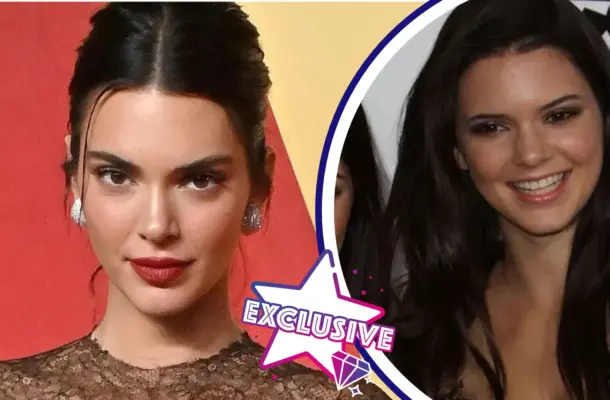 Uważana za jedną z bardziej naturalnych „Kardashianek”. Co poprawiała sobie Kendall Jenner? Lekarka odpowiada!