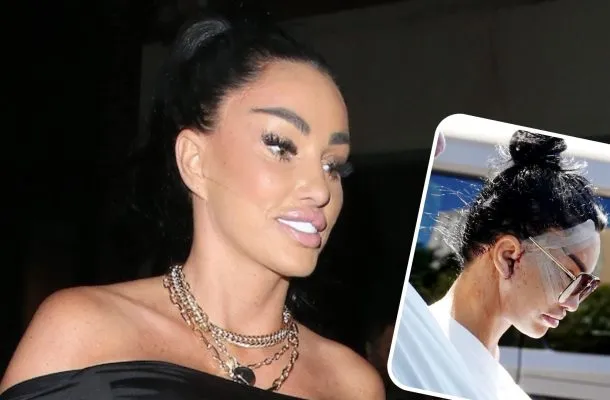 Katie Price po swoim 6 liftingu twarzy! Zauważona przed hotelem w Turcji