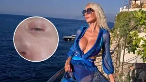 Aneta Glam przeżywa KOSZMAR na wakacjach! „Obudziłam się ze zdeformowaną twarzą” Aneta Glam przeżywa KOSZMAR na wakacjach! „Obudziłam się ze zdeformowaną twarzą”