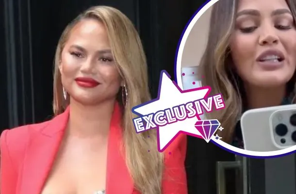 Chrissy Teigen PRZESADZIŁA z wypełniaczami? Lekarka mówi o efekcie „pillow face”!