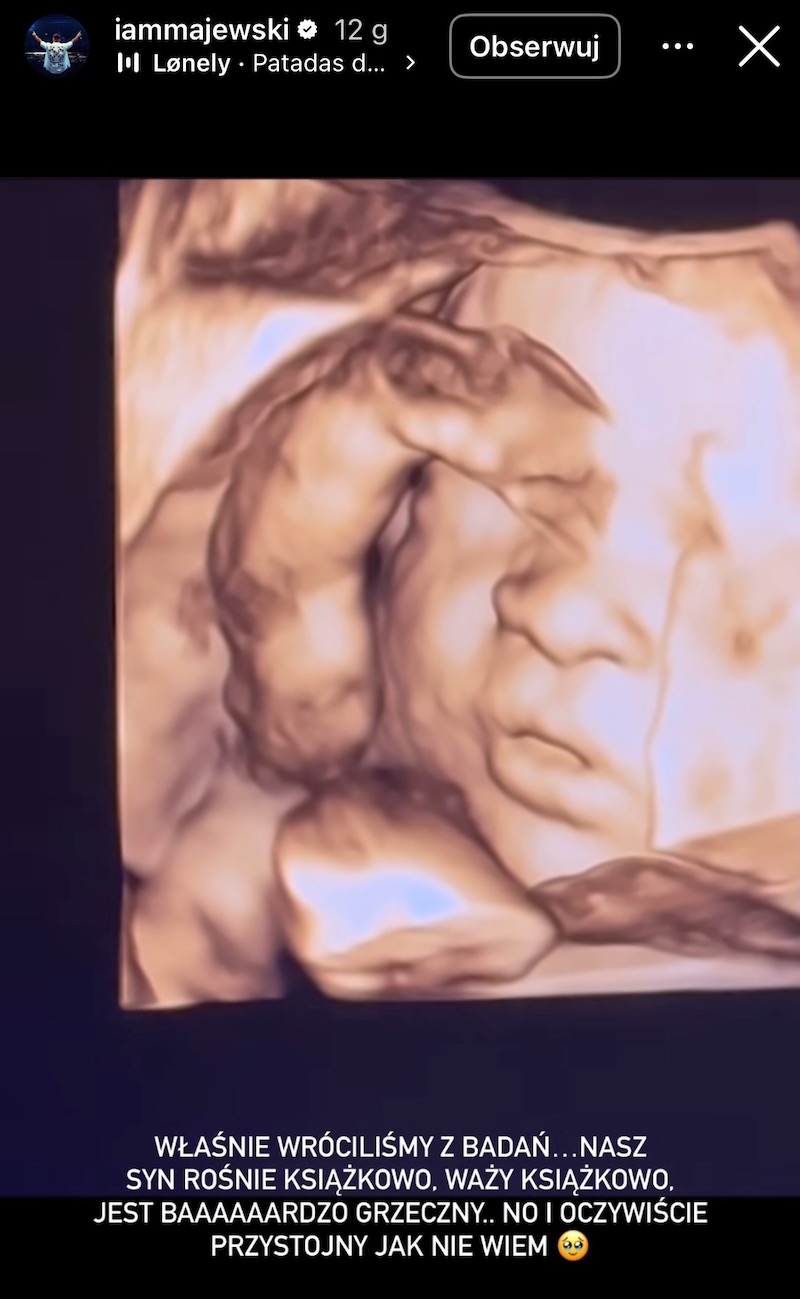 Deynn i Majewski dzielą się emocjami z badania USG